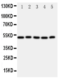 ALDH3A1 Antibody - Anti-ALDH3A1 antibody, Western blotting All lanes: Anti ALDH3A1 at 0.5ug/ml Lane 1: SMMC Whole Cell Lysate at 40ug Lane 2: HELA Whole Cell Lysate at 40ug Lane 3: COLO320 Whole Cell Lysate at 40ug Lane 4: MCF-7 Whole Cell Lysate at 40ug Lane 5: A549 Whole Cell Lysate at 40ug Predicted bind size: 50KD Observed bind size: 50KD