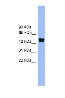 ALDH3A1 Antibody - ALDH3A1 antibody Western blot of Fetal Muscle lysate. Antibody concentration 1 ug/ml. This image was taken for the unconjugated form of this product. Other forms have not been tested.