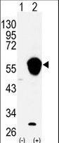ALDH3A1 Antibody - Western blot of ALDH3A1 (arrow) using rabbit polyclonal ALDH3A1 Antibody. 293 cell lysates (2 ug/lane) either nontransfected (Lane 1) or transiently transfected with the ALDH3A1 gene (Lane 2) (Origene Technologies).