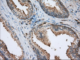 ALDH3A1 Antibody - IHC of paraffin-embedded prostate tissue using anti-ALDH3A1 mouse monoclonal antibody. (Dilution 1:50).