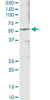 ALDH3A1 Antibody - Immunoprecipitation of ALDH3A1 transfected lysate using anti-ALDH3A1 monoclonal antibody and Protein A Magnetic Bead, and immunoblotted with ALDH3A1 rabbit polyclonal antibody.