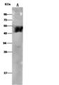 ALDH3A1 Antibody - Anti-ALDH3A1 rabbit monoclonal antibody at 1:500 dilution. Lane A: A549 Whole Cell Lysate. Lysates/proteins at 30 ug per lane. Secondary: Goat Anti-Rabbit IgG (H+L)/HRP at 1/10000 dilution. Developed using the ECL technique. Performed under reducing conditions. Predicted band size: 50 kDa. Observed band size: 50 kDa.