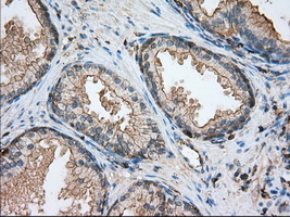 ALDH3A1 Antibody - IHC of paraffin-embedded prostate tissue using anti-ALDH3A1 mouse monoclonal antibody. (Dilution 1:50).