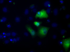 ALDH3A1 Antibody - Anti-ALDH3A1 mouse monoclonal antibody  immunofluorescent staining of COS7 cells transiently transfected by pCMV6-ENTRY ALDH3A1.
