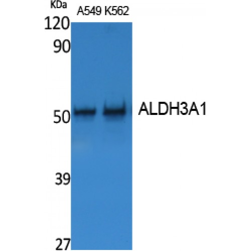 ALDH3A1 Antibody - Western blot of ALDH3A1 antibody
