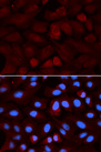 ALDH3A1 Antibody - Immunofluorescence analysis of U20S cells.