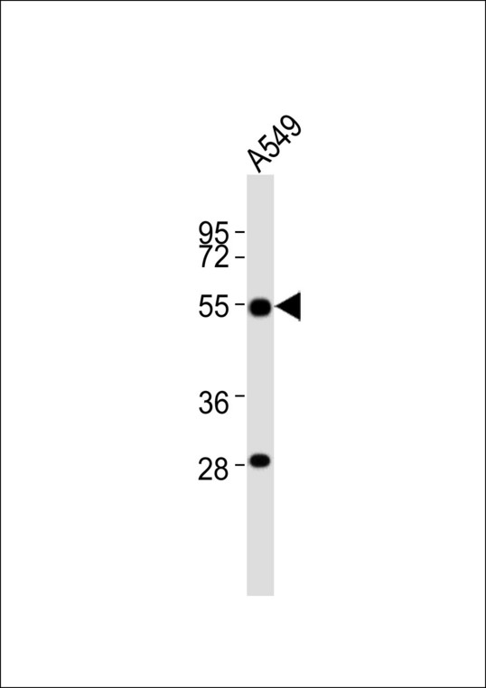 ALDH3A1 Antibody - Anti-ALDH3A1 Antibody at 1:1000 dilution + A549 whole cell lysates Lysates/proteins at 20 ug per lane. Secondary Goat Anti-Rabbit IgG, (H+L),Peroxidase conjugated at 1/10000 dilution Predicted band size : 50 kDa Blocking/Dilution buffer: 5% NFDM/TBST.