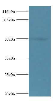 ALDH3A1 Antibody - Western blot. All lanes: ALDH3A1 antibody at 2 ug/ml+293T whole cell lysate. Secondary antibody: goat polyclonal to rabbit at 1:10000 dilution. Predicted band size: 50 kDa. Observed band size: 50 kDa.  This image was taken for the unconjugated form of this product. Other forms have not been tested.