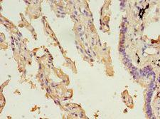 ALDH3A1 Antibody - Immunohistochemistry of paraffin-embedded human lung tissue using antibody at 1:100 dilution.  This image was taken for the unconjugated form of this product. Other forms have not been tested.