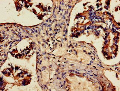 ALDH3A1 Antibody - Immunohistochemistry of paraffin-embedded human lung tissue using ALDH3A1 Antibody at dilution of 1:100