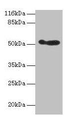 ALDH3A1 Antibody - Western blot All lanes: ALDH3A1 antibody at 2µg/ml + 293T whole cell lysate Secondary Goat polyclonal to rabbit IgG at 1/10000 dilution Predicted band size: 50 kDa Observed band size: 50 kDa