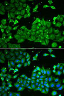 ALDH3A1 Antibody - Immunofluorescence analysis of HeLa cells using ALDH3A1 antibody. Blue: DAPI for nuclear staining.