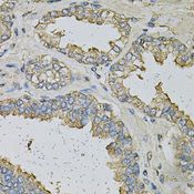 ALDH3A1 Antibody - Immunohistochemistry of paraffin-embedded human prostate using ALDH3A1 Antibody at dilution of 1:100 (40x lens).
