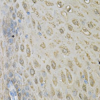 ALDH3A1 Antibody - Immunohistochemistry of paraffin-embedded human esophagus using ALDH3A1 Antibody at dilution of 1:100 (40x lens).