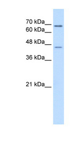 ALDH3A2 Antibody - ALDH3A2 antibody ARP44274_P050-NP_000373-ALDH3A2(aldehyde dehydrogenase 3 family, member A2) Antibody Western blot of Jurkat lysate.  This image was taken for the unconjugated form of this product. Other forms have not been tested.