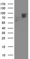 ALDH3A2 Antibody - HEK293T cells were transfected with the pCMV6-ENTRY control (Left lane) or pCMV6-ENTRY ALDH3A2 (Right lane) cDNA for 48 hrs and lysed. Equivalent amounts of cell lysates (5 ug per lane) were separated by SDS-PAGE and immunoblotted with anti-ALDH3A2.