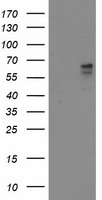 ALDH3A2 Antibody - HEK293T cells were transfected with the pCMV6-ENTRY control (Left lane) or pCMV6-ENTRY ALDH3A2 (Right lane) cDNA for 48 hrs and lysed. Equivalent amounts of cell lysates (5 ug per lane) were separated by SDS-PAGE and immunoblotted with anti-ALDH3A2.