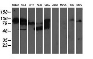 ALDH3A2 Antibody - Western blot of extracts (35 ug) from 9 different cell lines by using anti-ALDH3A2 monoclonal antibody (HepG2: human; HeLa: human; SVT2: mouse; A549: human; COS7: monkey; Jurkat: human; MDCK: canine; PC12: rat; MCF7: human).