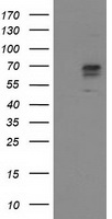 ALDH3A2 Antibody - HEK293T cells were transfected with the pCMV6-ENTRY control (Left lane) or pCMV6-ENTRY ALDH3A2 (Right lane) cDNA for 48 hrs and lysed. Equivalent amounts of cell lysates (5 ug per lane) were separated by SDS-PAGE and immunoblotted with anti-ALDH3A2.