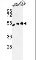 ALDH3A2 Antibody - Western blot of ALDH3A2 Antibody in HeLa, HepG2, WiDr cell line lysates (35 ug/lane). ALDH3A2 (arrow) was detected using the purified antibody.