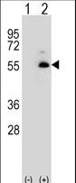 ALDH3A2 Antibody - Western blot of ALDH3A2 (arrow) using rabbit polyclonal ALDH3A2 Antibody. 293 cell lysates (2 ug/lane) either nontransfected (Lane 1) or transiently transfected (Lane 2) with the ALDH3A2 gene.