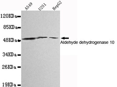 ALDH3A2 Antibody - Western blot detection of Aldehyde dehydrogenase 10 in A549, U251 and HepG2 cell lysates using Aldehyde dehydrogenase 10 mouse monoclonal antibody (1:1000 dilution). Predicted band size: 55KDa. Observed band size:55KDa.