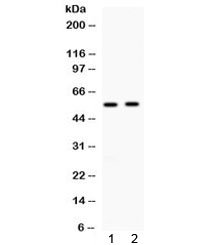 ALDH3A2 Antibody - Western blot testing of 1) rat liver and 2) human 22RV1 lysate with ALDH3A2 antibody at 0.5ug/ml. Predicted molecular weight: ~54kDa.