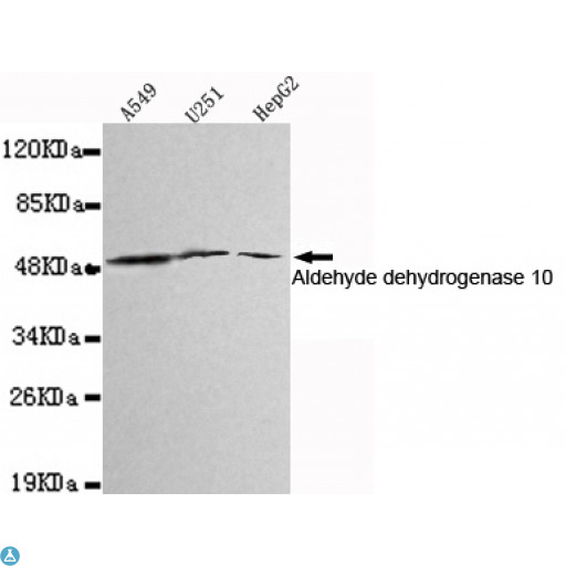 ALDH3A2 Antibody - Western blot detection of Aldehyde dehydrogenase 10 in A549, U251 and HepG2 cell lysates using Aldehyde dehydrogenase 10 mouse mAb (1:1000 diluted). Predicted band size: 55KDa. Observed band size: 55KDa.