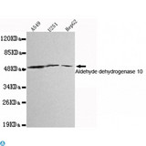 ALDH3A2 Antibody - Western blot detection of Aldehyde dehydrogenase 10 in A549, U251 and HepG2 cell lysates using Aldehyde dehydrogenase 10 mouse mAb (1:1000 diluted). Predicted band size: 55KDa. Observed band size: 55KDa.