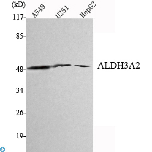 ALDH3A2 Antibody - Western Blot (WB) analysis using ALDH3A2 Monoclonal Antibody against A549, U251, HepG2 cell lysate.