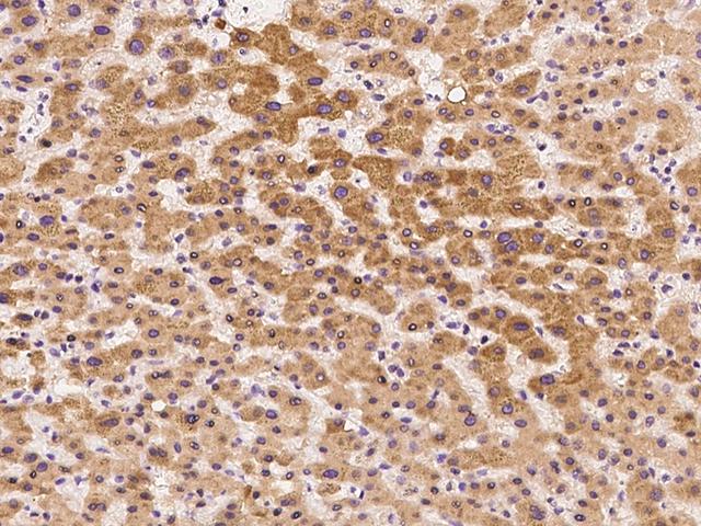 ALDH3A2 Antibody - Immunochemical staining of human ALDH3A2 in human liver with rabbit polyclonal antibody at 1:300 dilution, formalin-fixed paraffin embedded sections.