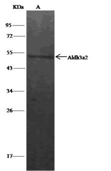 ALDH3A2 Antibody - Aldh3a2 was immunoprecipitated using: Lane A: 0.5 mg A549 Whole Cell Lysate. 0.5 uL anti-Aldh3a2 rabbit polyclonal antibody and 15 ul of 50% Protein G agarose. Primary antibody: Anti-Aldh3a2 rabbit polyclonal antibody, at 1:500 dilution. Secondary antibody: Clean-Blot IP Detection Reagent (HRP) at 1:500 dilution. Developed using the DAB staining technique. Performed under reducing conditions. Predicted band size: 53 kDa. Observed band size: 53 kDa.
