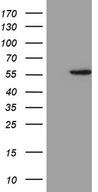 ALDH3B1 Antibody - HEK293T cells were transfected with the pCMV6-ENTRY control. (Left lane) or pCMV6-ENTRY ALDH3B1. (Right lane) cDNA for 48 hrs and lysed. Equivalent amounts of cell lysates. (5 ug per lane) were separated by SDS-PAGE and immunoblotted with anti-ALDH3B1. (1:2000)