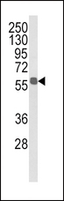 ALDH3B1 Antibody - Western blot of ALDH3B1 Antibody in MDA-MB231 cell line lysates (35 ug/lane). ALDH3B1 (arrow) was detected using the purified antibody.