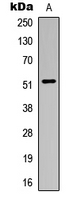 ALDH3B1 Antibody - Western blot analysis of ALDH3B1 expression in HUVEC (A) whole cell lysates.