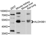 ALDH3B1 Antibody - Western blot analysis of extracts of various cell lines, using ALDH3B1 antibody at 1:1000 dilution. The secondary antibody used was an HRP Goat Anti-Rabbit IgG (H+L) at 1:10000 dilution. Lysates were loaded 25ug per lane and 3% nonfat dry milk in TBST was used for blocking. An ECL Kit was used for detection and the exposure time was 5s.