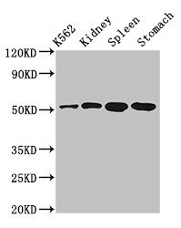 ALDH3B1 Antibody - Positive Western Blot detected in K562 whole cell lysate, Rat kidney tissue, Rat spleen tissue, Mouse stomach tissue. All lanes: ALDH3B1 antibody at 3 µg/ml Secondary Goat polyclonal to rabbit IgG at 1/50000 dilution. Predicted band size: 52 KDa. Observed band size: 52 KDa