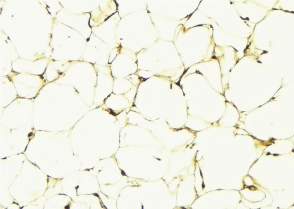 ALDH3B1 Antibody - 1:100 staining human lung tissue by IHC-P. The sample was formaldehyde fixed and a heat mediated antigen retrieval step in citrate buffer was performed. The sample was then blocked and incubated with the antibody for 1.5 hours at 22°C. An HRP conjugated goat anti-rabbit antibody was used as the secondary.