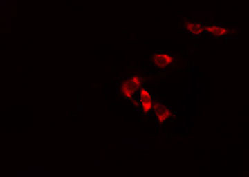 ALDH3B1 Antibody - Staining HuvEc cells by IF/ICC. The samples were fixed with PFA and permeabilized in 0.1% Triton X-100, then blocked in 10% serum for 45 min at 25°C. The primary antibody was diluted at 1:200 and incubated with the sample for 1 hour at 37°C. An Alexa Fluor 594 conjugated goat anti-rabbit IgG (H+L) antibody, diluted at 1/600, was used as secondary antibody.