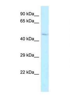ALDH3B2 Antibody - ALDH3B2 antibody Western blot of Fetal Lung lysate. Antibody concentration 1 ug/ml.  This image was taken for the unconjugated form of this product. Other forms have not been tested.