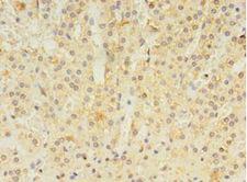 ALDH3B2 Antibody - Immunohistochemistry of paraffin-embedded human adrenal gland using antibody at 1:100 dilution.  This image was taken for the unconjugated form of this product. Other forms have not been tested.