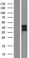ALDH3B2 Protein - Western validation with an anti-DDK antibody * L: Control HEK293 lysate R: Over-expression lysate