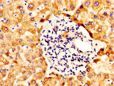 ALDH5A1 Antibody - Immunohistochemistry of paraffin-embedded human liver tissue using ALDH5A1 Antibody at dilution of 1:100