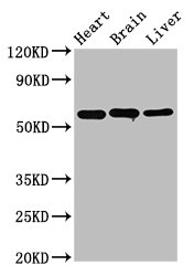ALDH5A1 Antibody - Western blot All lanes: ALDH5A1 antibody at 8µg/ml Lane 1: Rat heart tissue Lane 2: Mouse liver tissue Lane 3: Mouse kidney tissue Lane 4: A431 whole cell lysate Lane 5: 293T whole cell lysate Secondary Goat polyclonal to rabbit IgG at 1/10000 dilution Predicted band size: 58, 59 kDa Observed band size: 58, 52 kDa