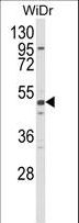 ALDH5A1 Antibody - Western blot of ALDH5A1 Antibody in WiDr cell line lysates (35 ug/lane). ALDH5A1 (arrow) was detected using the purified antibody.