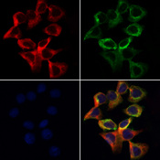 ALDH5A1 Antibody - Staining HeLa cells by IF/ICC. The samples were fixed with PFA and permeabilized in 0.1% Triton X-100, then blocked in 10% serum for 45 min at 25°C. Samples were then incubated with primary Ab(1:200) and mouse anti-beta tubulin Ab(1:200) for 1 hour at 37°C. An AlexaFluor594 conjugated goat anti-rabbit IgG(H+L) Ab(1:200 Red) and an AlexaFluor488 conjugated goat anti-mouse IgG(H+L) Ab(1:600 Green) were used as the secondary antibod