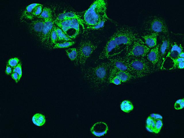 ALDH5A1 Antibody - Immunofluorescence staining of ALDH5A1 in CACO2 cells. Cells were fixed with 4% PFA, permeabilzed with 0.1% Triton X-100 in PBS, blocked with 10% serum, and incubated with rabbit anti-Human ALDH5A1 polyclonal antibody (dilution ratio 1:200) at 4°C overnight. Then cells were stained with the Alexa Fluor 488-conjugated Goat Anti-rabbit IgG secondary antibody (green) and counterstained with DAPI (blue). Positive staining was localized to Cytoplasm.