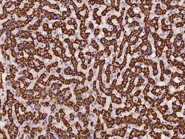 ALDH5A1 Antibody - Immunochemical staining of human ALDH5A1 in human liver with rabbit polyclonal antibody at 1:500 dilution, formalin-fixed paraffin embedded sections.