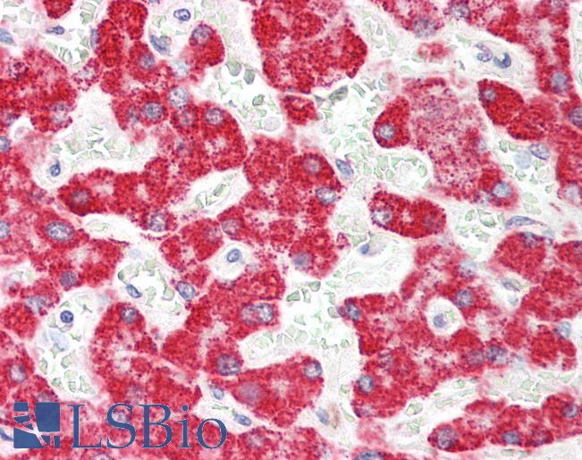 ALDH6A1 Antibody - Human Liver: Formalin-Fixed, Paraffin-Embedded (FFPE).  This image was taken for the unconjugated form of this product. Other forms have not been tested.