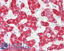 ALDH6A1 Antibody - Human Liver: Formalin-Fixed, Paraffin-Embedded (FFPE).  This image was taken for the unconjugated form of this product. Other forms have not been tested.